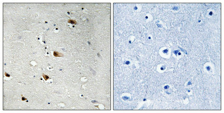 Anti-Phospho-TCF3 (Thr355)