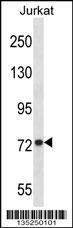 Anti-MFN1, ID (MFN1, Mitofusin-1, Fzo homolog, Transmembrane GTPase MFN1)