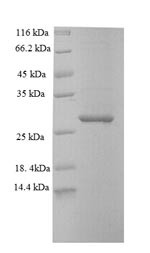 SAM domain and HD domain-containing protein 1 (SAMHD1), partial, mouse, recombinant