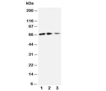 Anti-CX3CL1