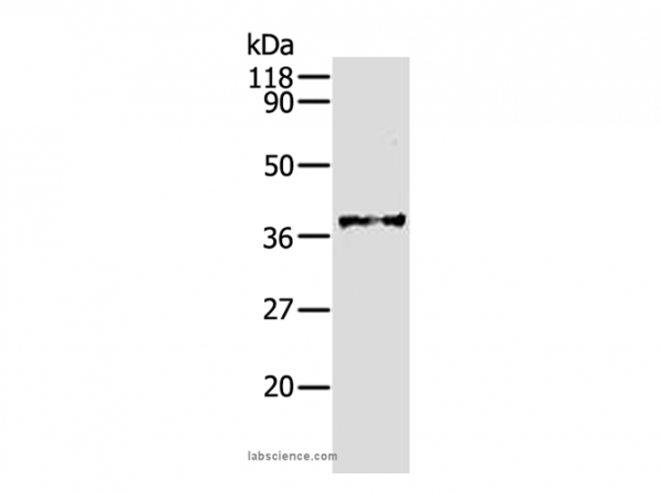 Anti-AKR1B1