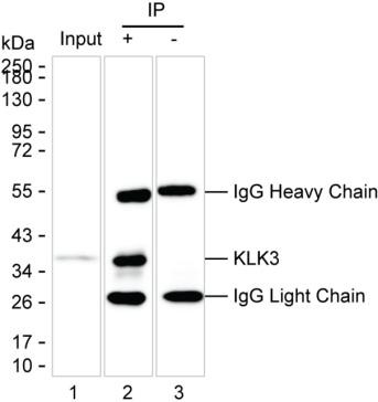 Anti-KLK3