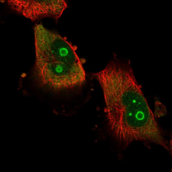 Anti-ATXN7L2