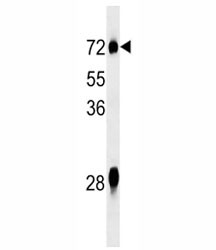 Anti-NOX3