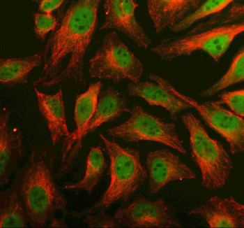 Anti-PRDM6 / PR domain zinc finger protein 6
