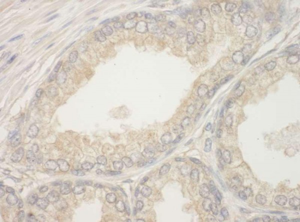 Anti-BAD (IHC)