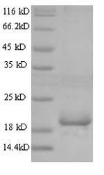 Angiopoietin-like protein 8 (Angptl8), mouse, recombinant