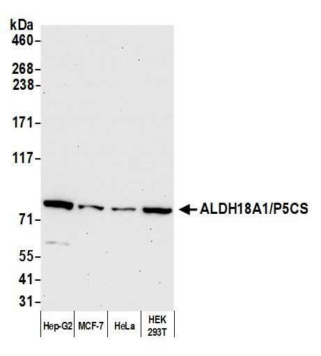 Anti-ALDH18A1/P5CS