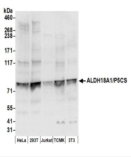 Anti-ALDH18A1/P5CS