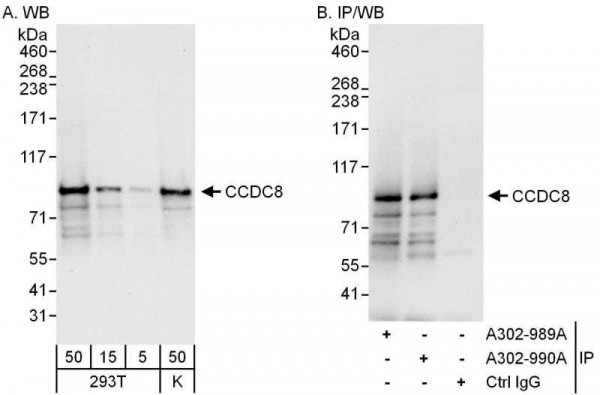 Anti-CCDC8