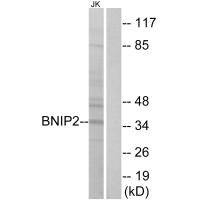 Anti-BNIP2