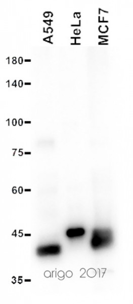 Anti-Keratin 18, clone 2B5-B6-F7