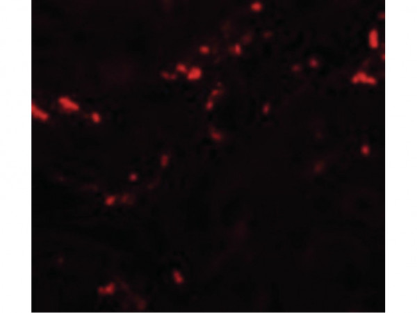 Anti-TCTN1