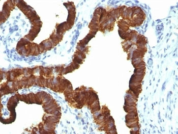 Anti-KRT7 / Cytokeratin 7, clone KRT7/1198