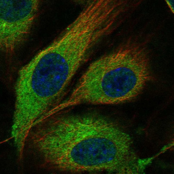 Anti-MMRN1