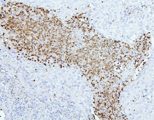 Anti-CD66e / CEA