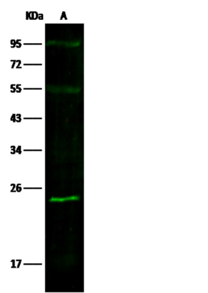 Anti-SOD2 Monoclonal Recombinant Antibody