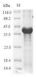 UDP-3-O-acyl-N-acetylglucosamine deacetylase (lpxC), Escherichia coli, recombinant