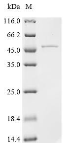 Poly [ADP-ribose] polymerase tankyrase-2 (TNKS2), partial, recombinant human
