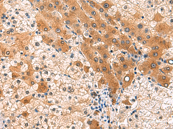 Anti-PCYT2
