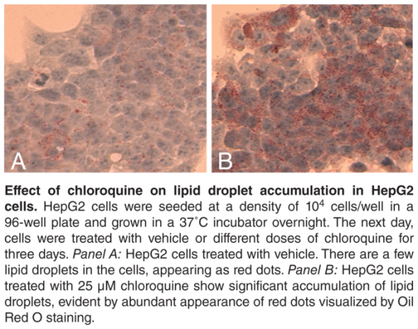 Steatosis Colorimetric Assay Kit