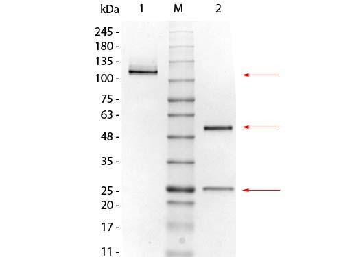 Mouse IgG1 Kappa myeloma protein