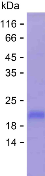 Recombinant Human GALNS Protein