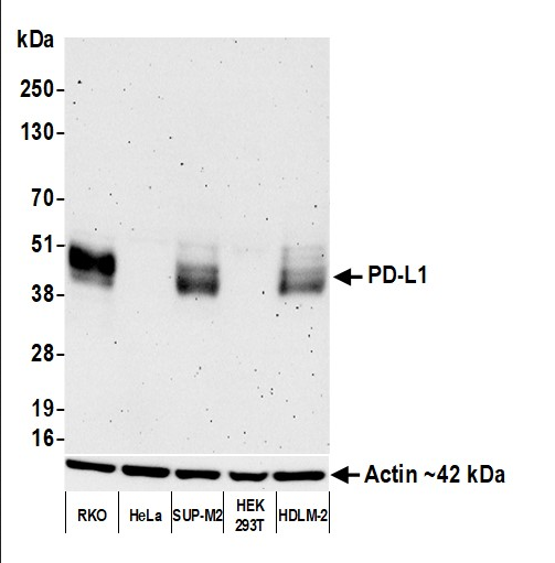 Anti-PD-L1 Recombinant Monoclonal