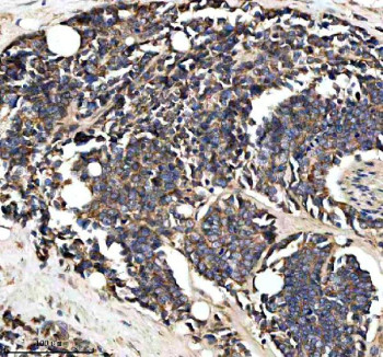 Anti-PTCD3 / Pentatricopeptide repeat domain-containing protein 3