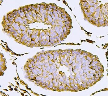 Anti-NECTIN2 / Nectin 2