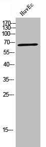 Anti-IGF2BP2