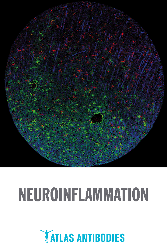 Atlas Antibodies Neuroinflammation White Paper