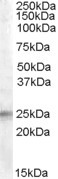 Anti-IGFBP6, Internal
