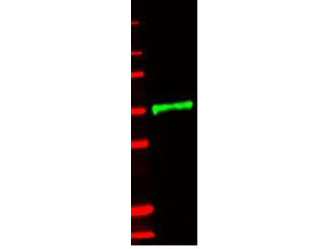 Anti-Interleukin-1 Receptor Type II (IL-1RII) (human)