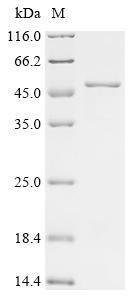Ubiquitin carboxyl-terminal hydrolase 21 (USP21), partial, human, recombinant