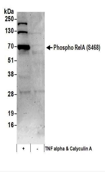 Anti-phospho-RelA (Ser468)