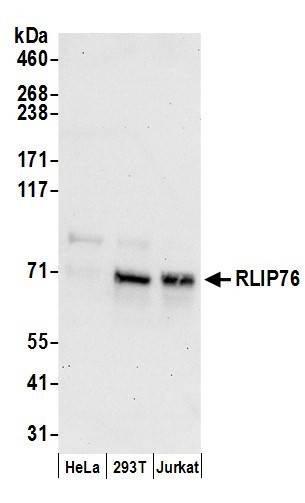 Anti-RLIP76