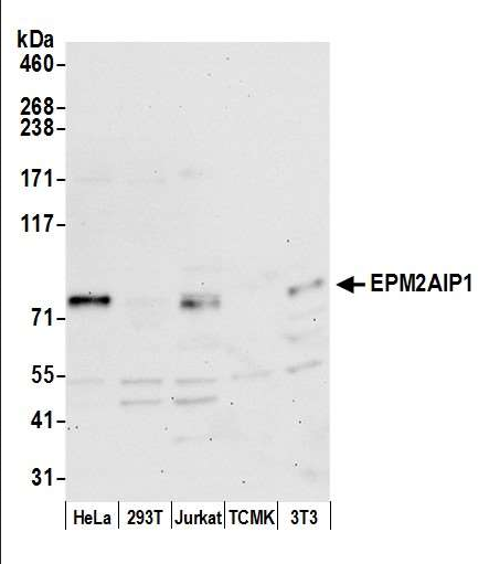 Anti-EPM2AIP1