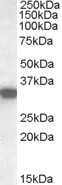 Anti-HADH / HADHSC, Internal