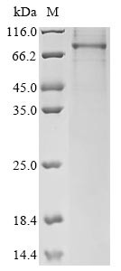 Follicle-stimulating hormone receptor (FSHR), partial, human, recombinant