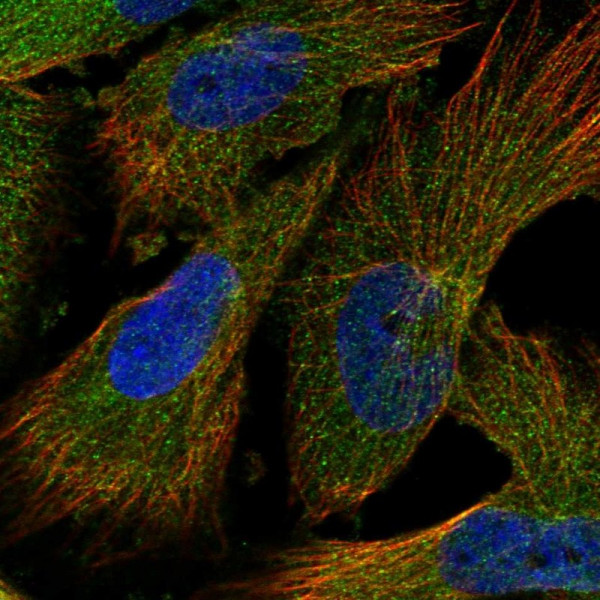 Anti-INPP5B