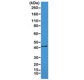 Anti-Alpha Smooth Muscle Actin / ACTA2, clone RM253 (recombinant antibody)