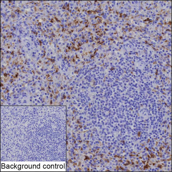 Anti-Heme Oxygenase 1