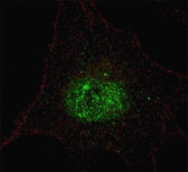 Anti-phospho-PDX1 (Thr11)