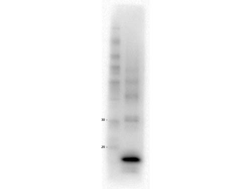 Anti-Procalcitonin, clone 9G4.C3.F2