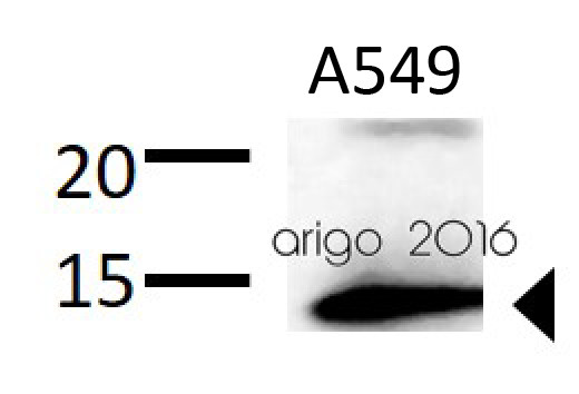 Anti-Galectin-1, clone SP247