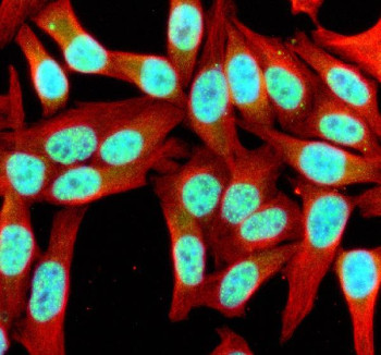 Anti-SIK1 / Salt-inducible kinase 1