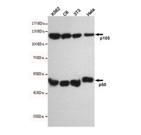 Anti-NFKB1, clone 5E3-E4-C11