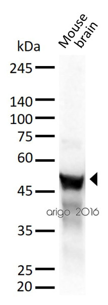 Anti-NSE / Neuron Specific Enolase