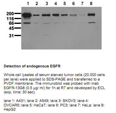 Anti-EGF Receptor (C-term), clone 13G8